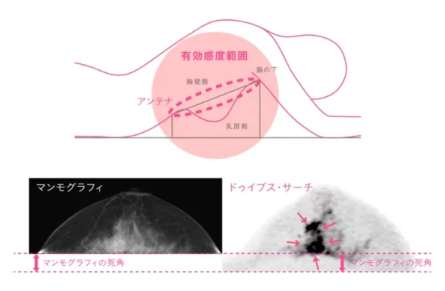 X線の比較画像