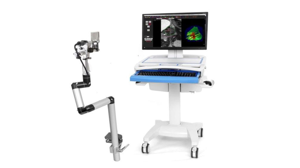 超音波融合システム前立腺生検