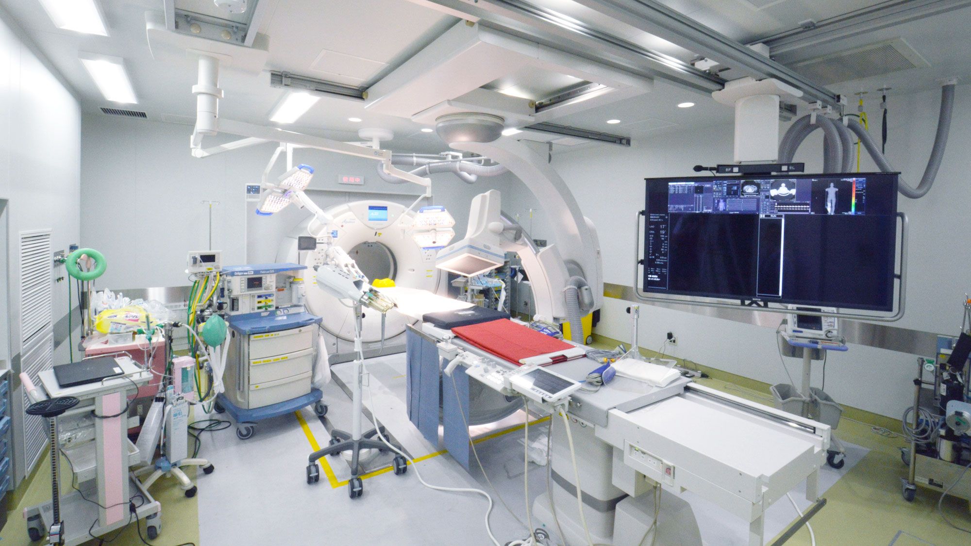 ハイブリッドER