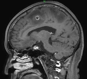 頭部造影MRI検査画像