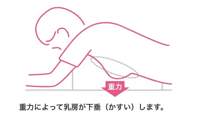 重力によって下垂する乳房の図解。女性がドゥイブス・サーチの機器に寝そべっている。