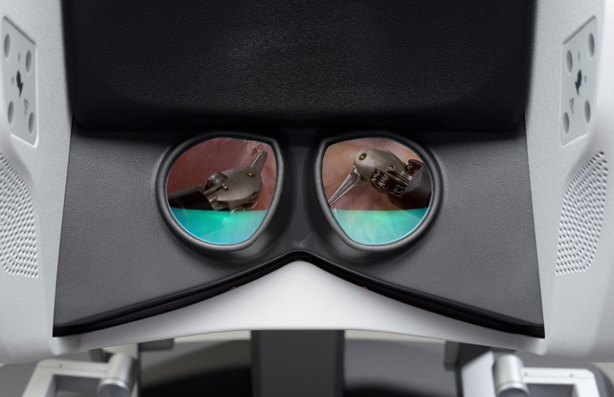 ダ・ヴィンチの内視鏡3Dカメラの画像