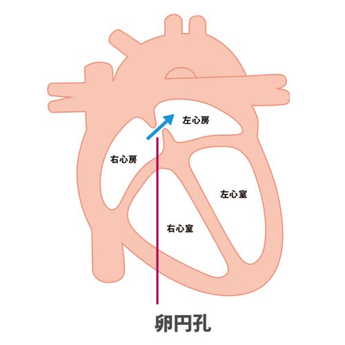 心臓の断面図。卵円孔の位置が示されている。