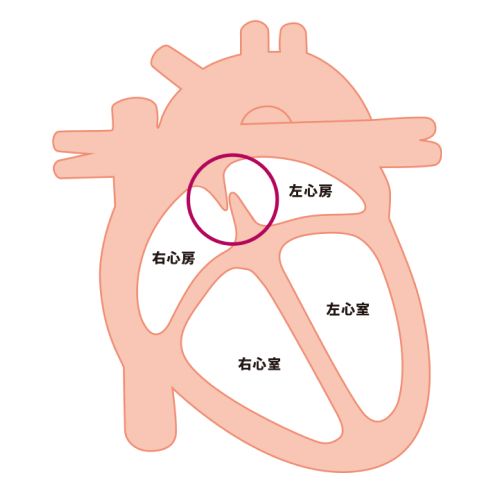 心臓の断面図。閉鎖した卵円孔の状態が示されている。