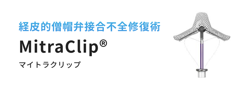 経皮的僧帽弁接合不全修復術 MitraClip