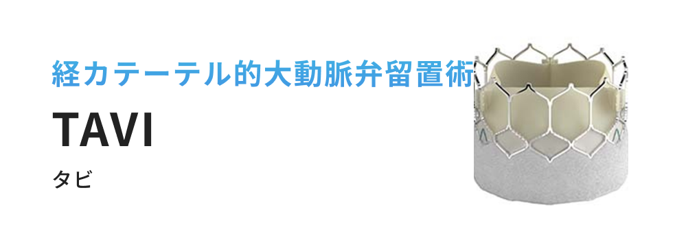 経カテーテル的大動脈弁留置術 TAVI
